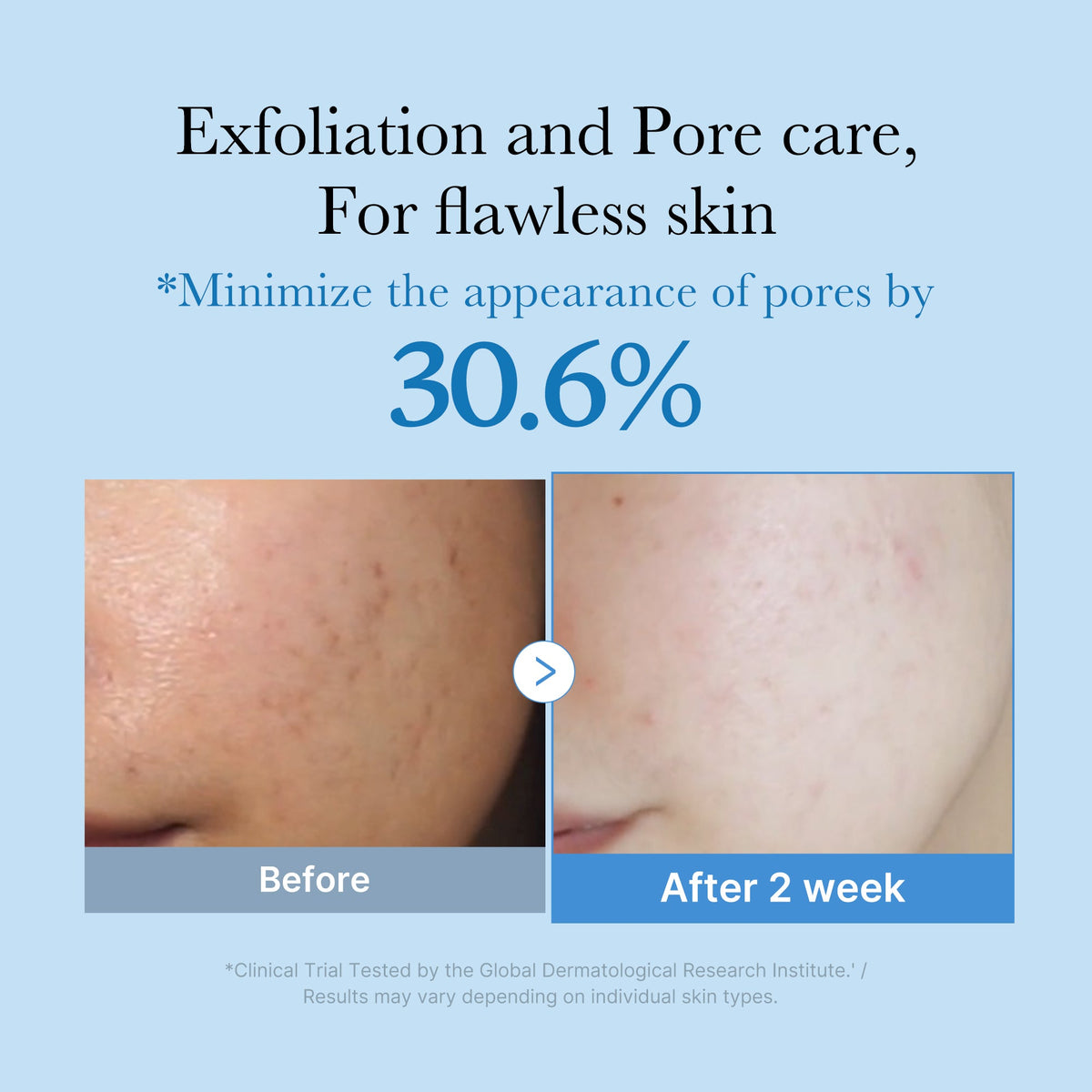 Zero Pore Toner N2