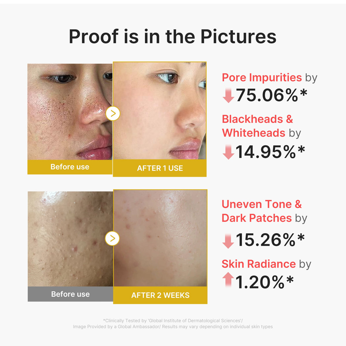 Kojic Acid Turmeric Peel Shot L7