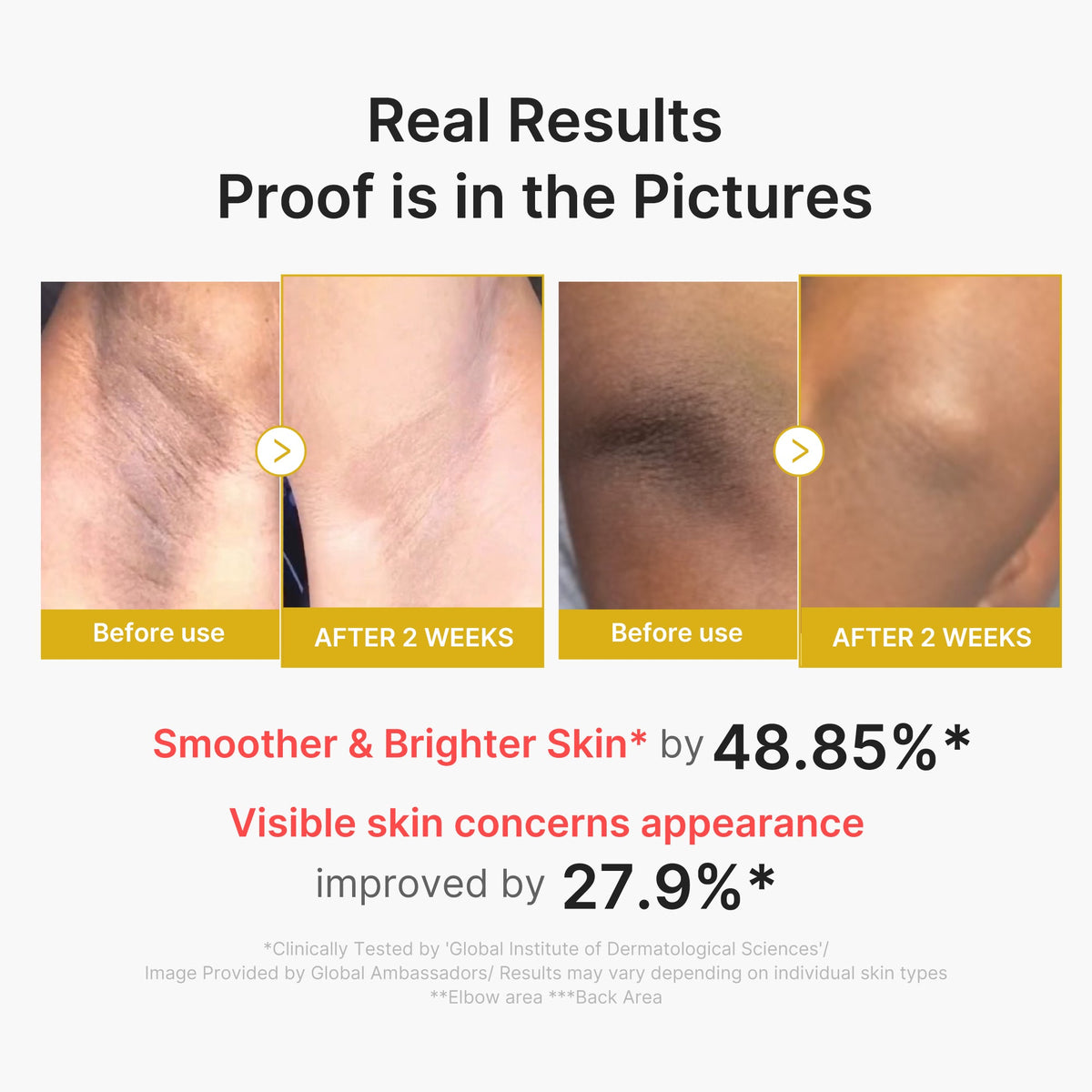 Kojic Acid Turmeric Body Peel Shot A1