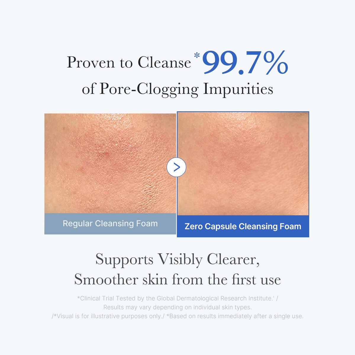 Zero Pore Capsule Cleansing Foam Z4