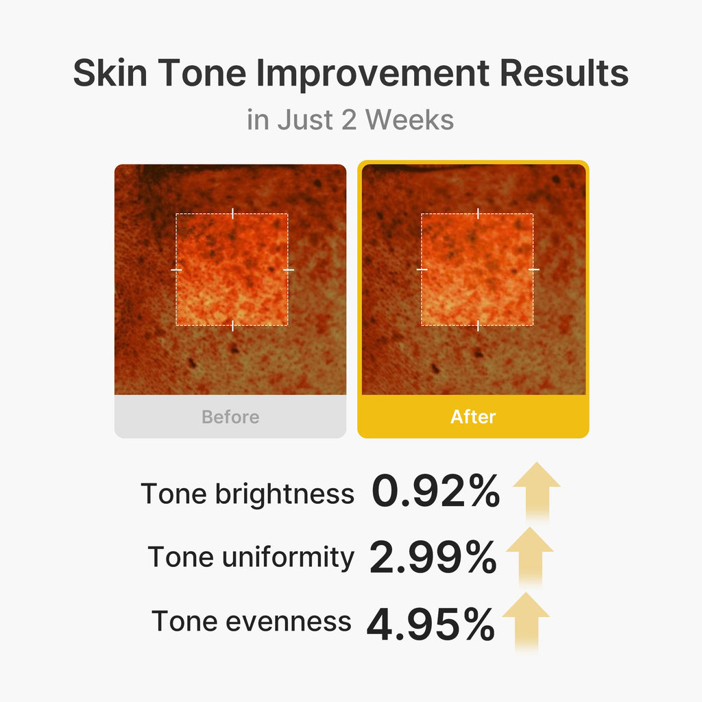 Kojic Acid Turmeric Vita Capsule Cream Q9