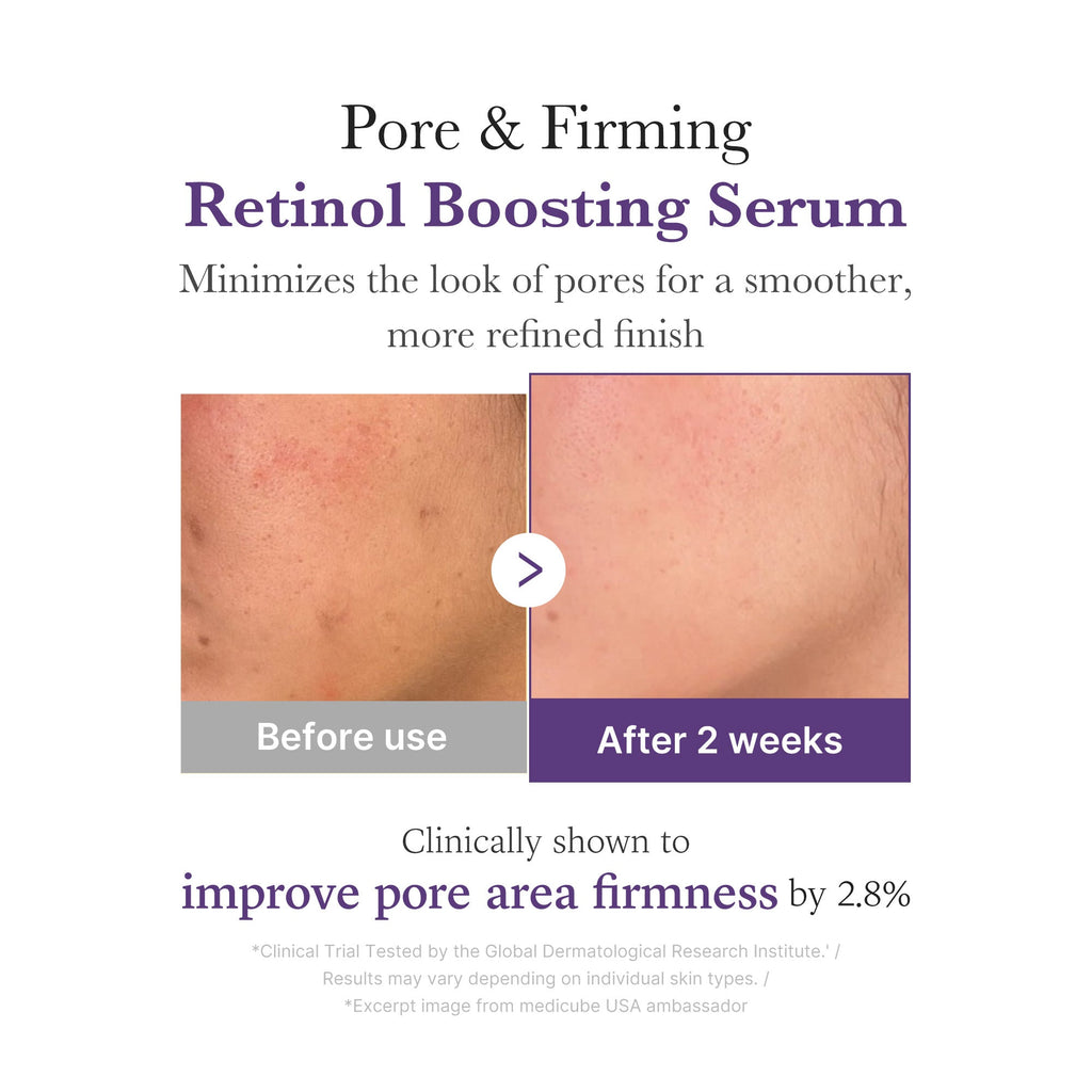 Retinol NMN Boosting Serum R3