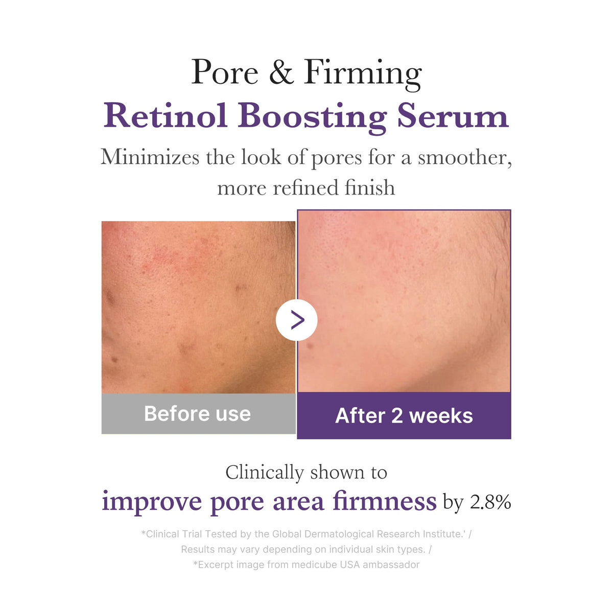 Retinol NMN Boosting Serum R3