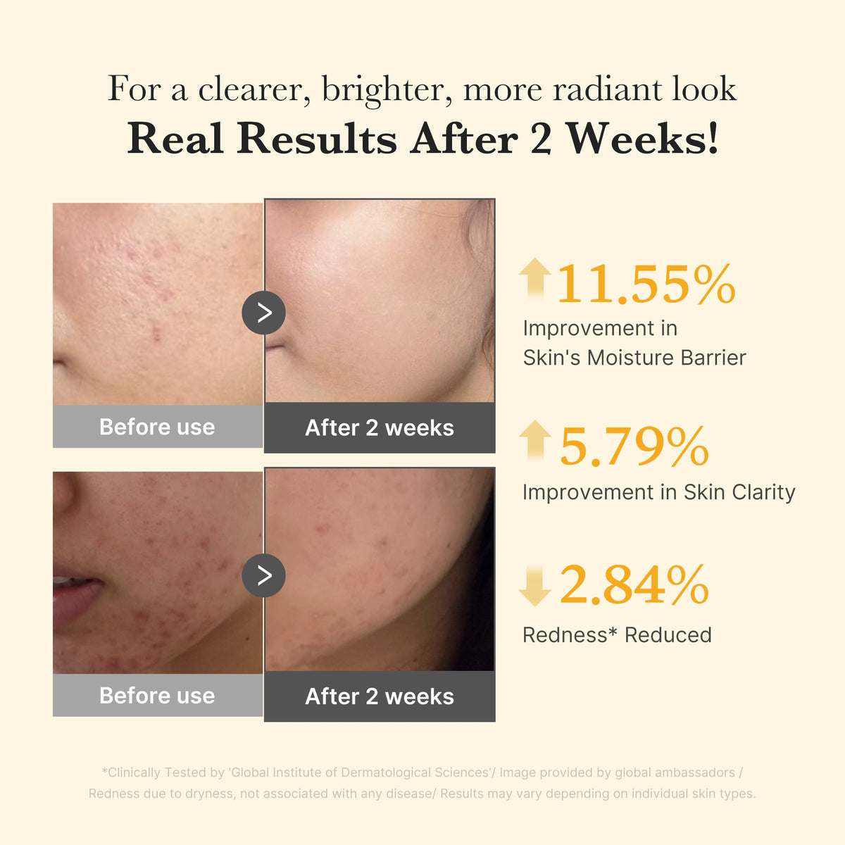 Kojic Acid Turmeric Capsule Serum O0