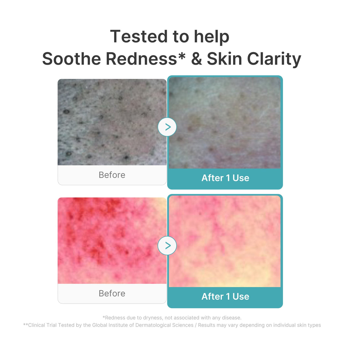 Azelaic Acid Capsule Foam Cleanser Z6