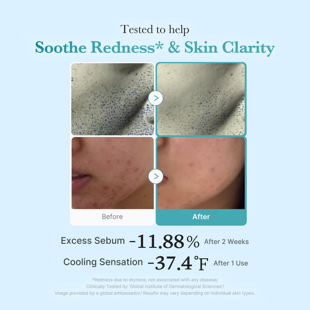 Azelaic Acid Niacinamide Clarifying Toner W7