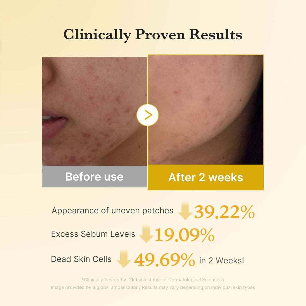 Kojic Acid Tumeric Toner Pad G3