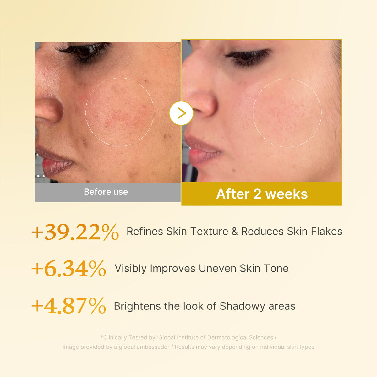 Kojic Acid Turmeric Toner Y5