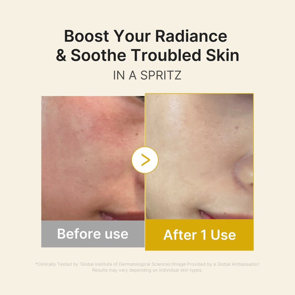 Kojic Acid Turmeric Vitamin Gold Jelly Mist Serum I9
