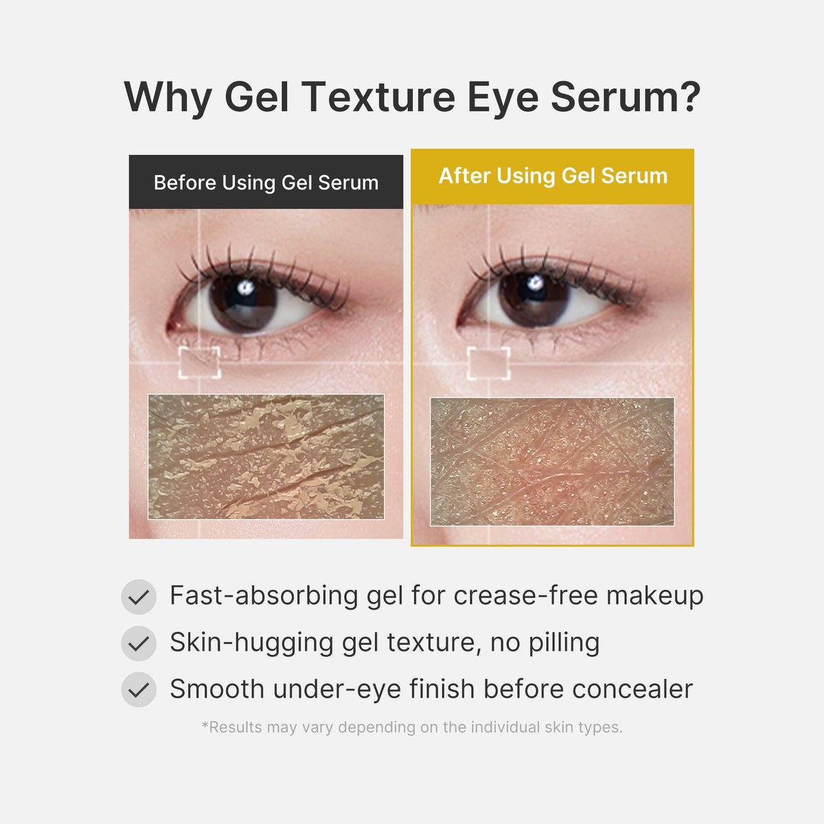 Kojic Acid Tumeric Eye Gel Serum V4