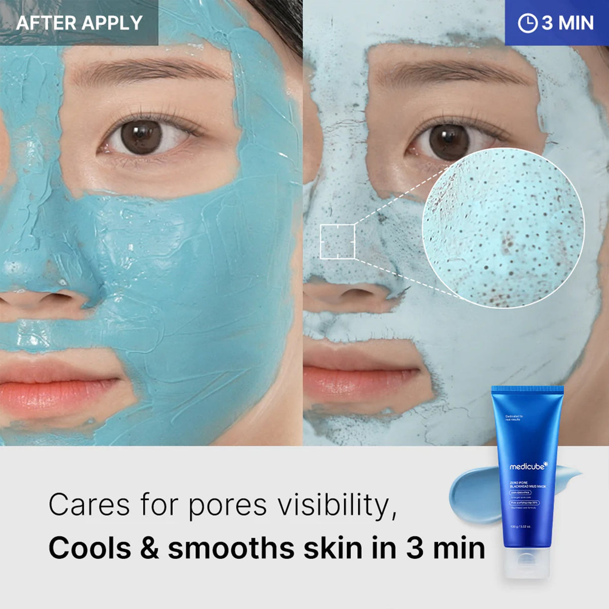 Zero Pore Blackhead Mud Mask E2