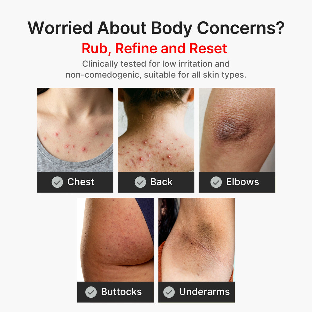 Kojic Acid Turmeric Body Peel Shot A1