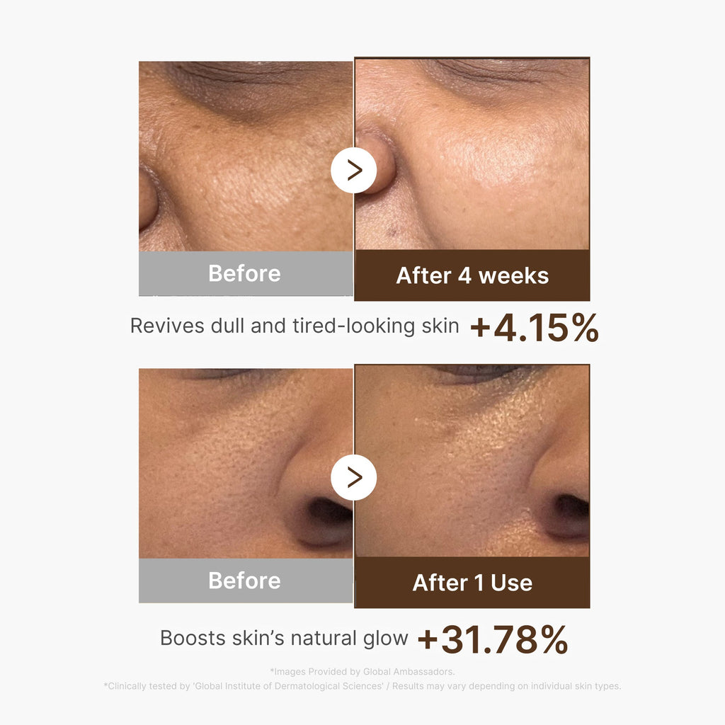 Deep Vitamin C Capsule Serum B9