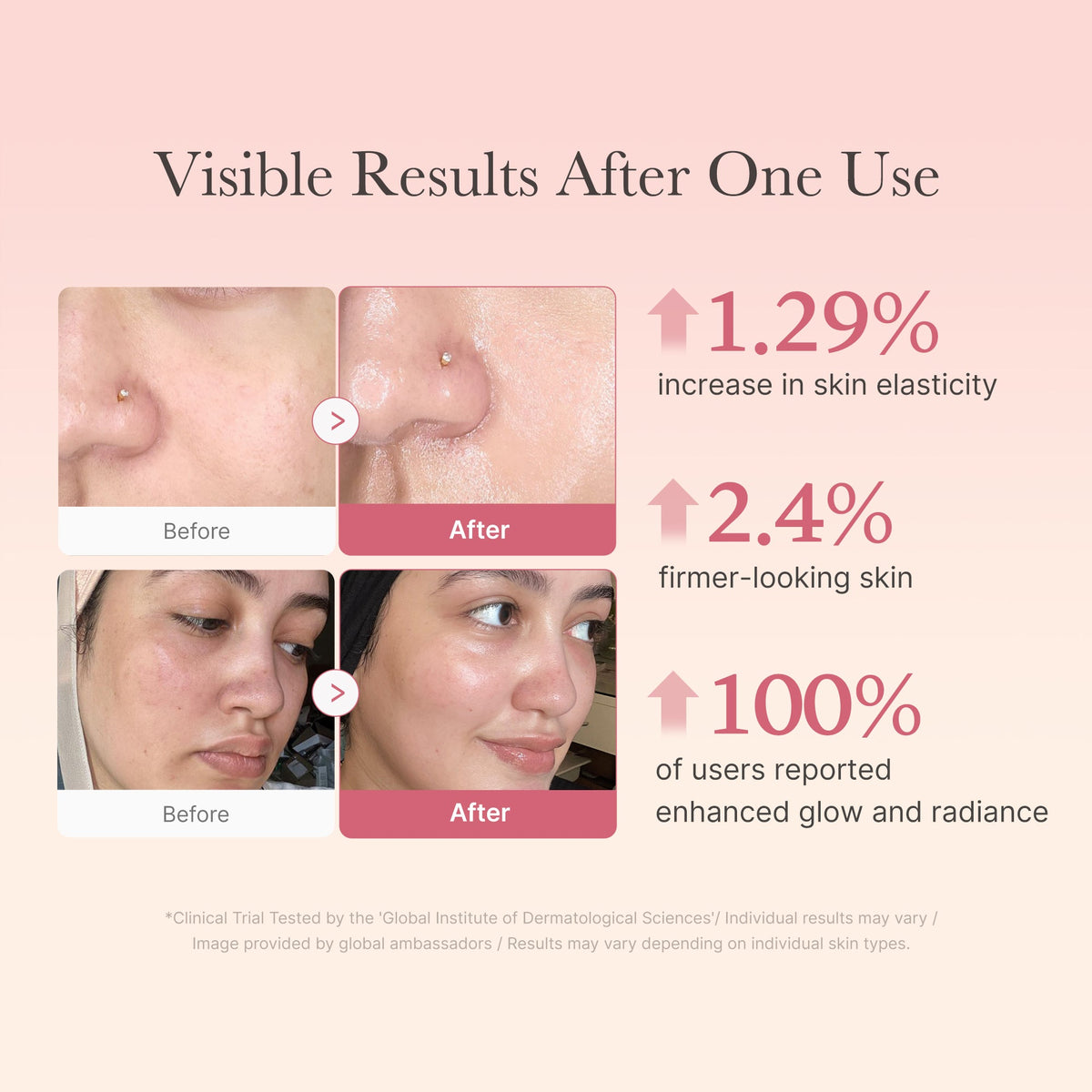 Collagen Niacinamide Jelly Cream U4