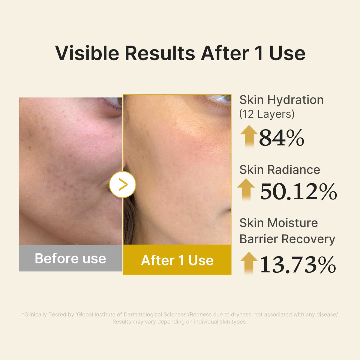 Kojic Acid Turmeric Vitamin Gold Jelly Mist Serum I9