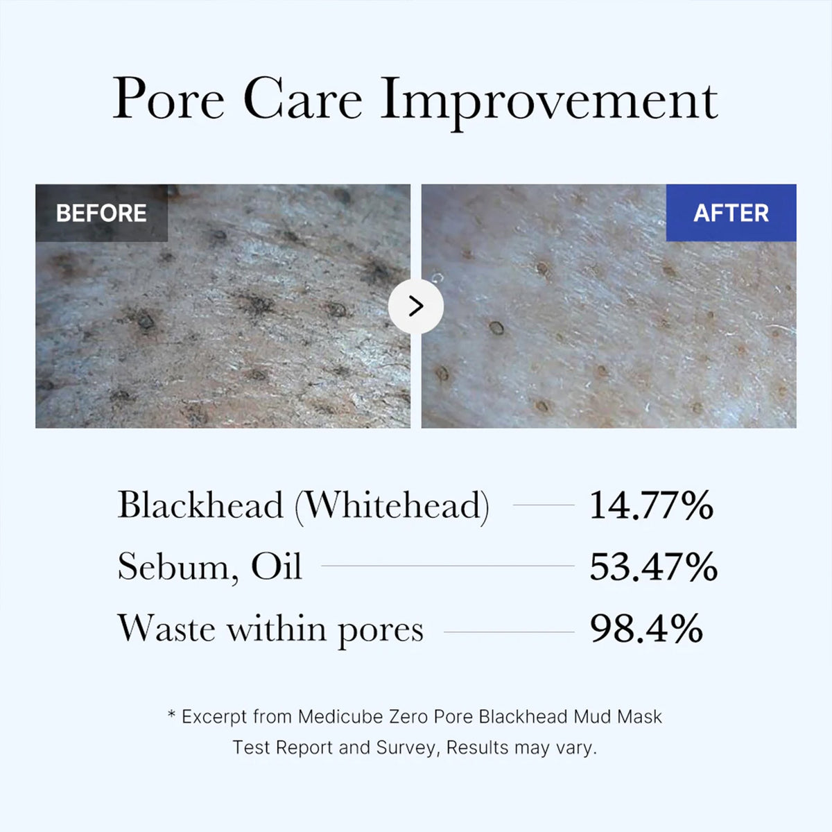 Zero Pore Blackhead Mud Mask E2