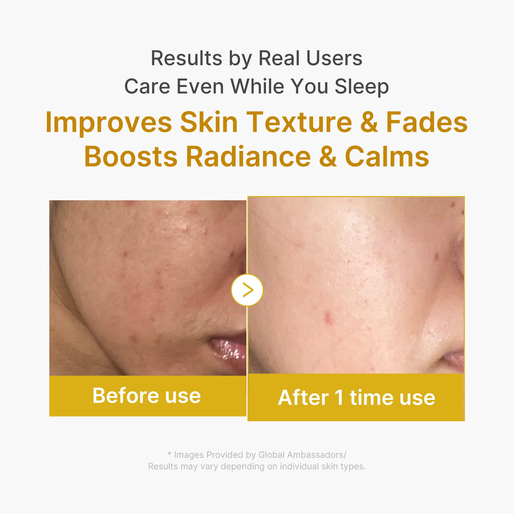 Kojic Acid Turmeric Overnight Wrapping Mask I4
