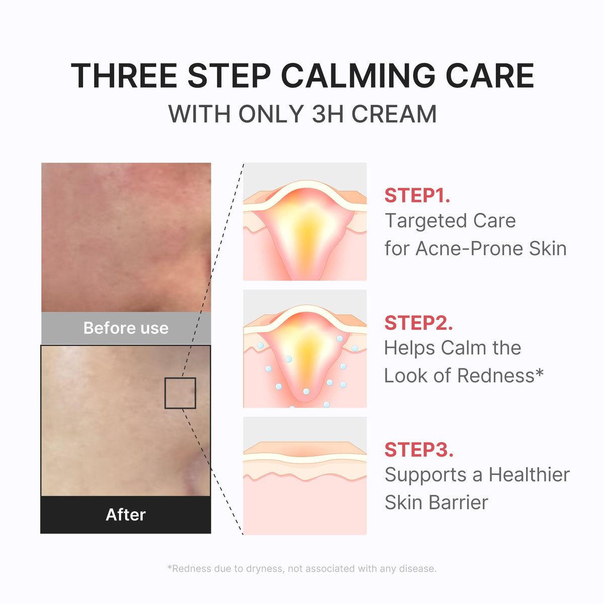 3H Daily Relief Cream E3
