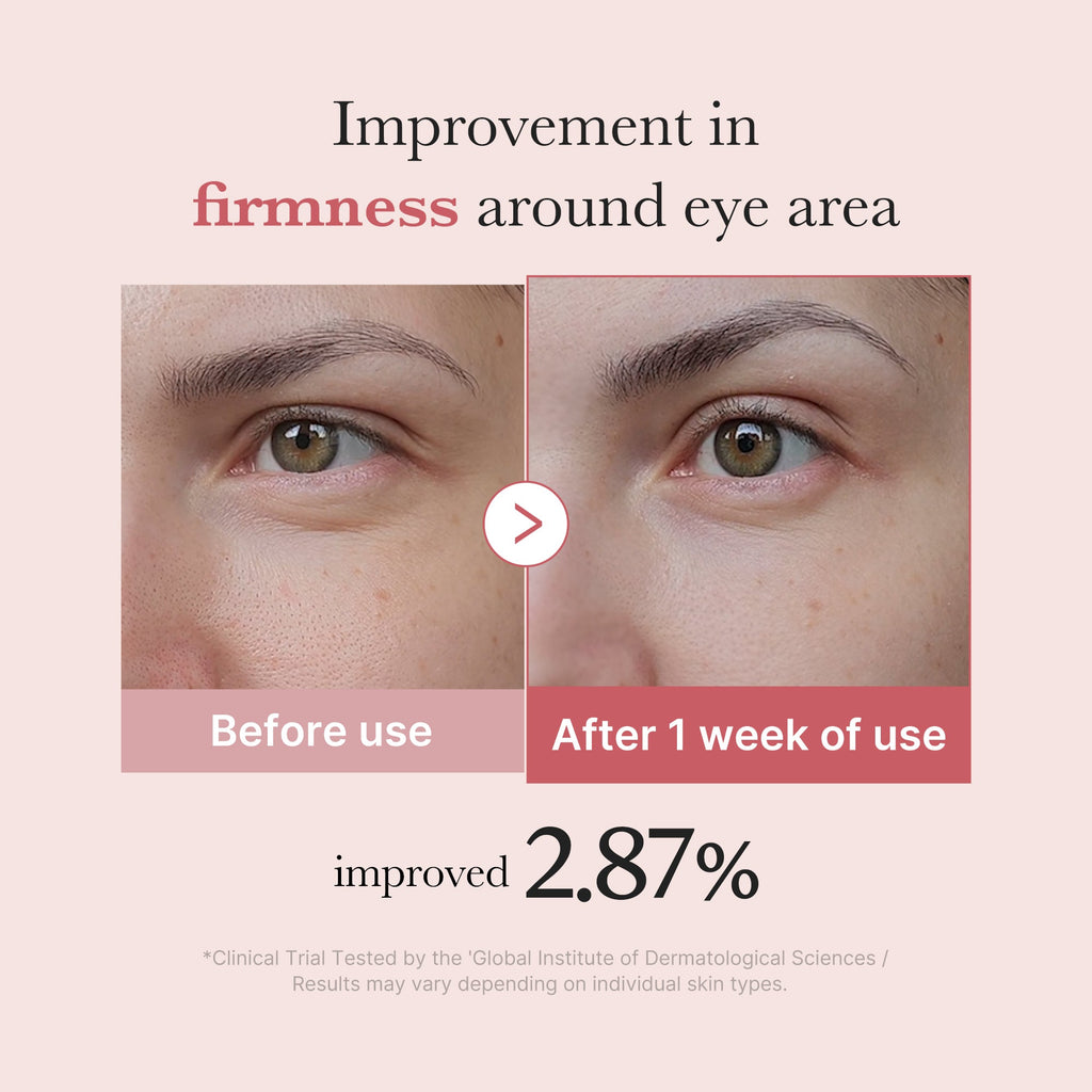 PDRN Pink Peptide Eye Cream F8