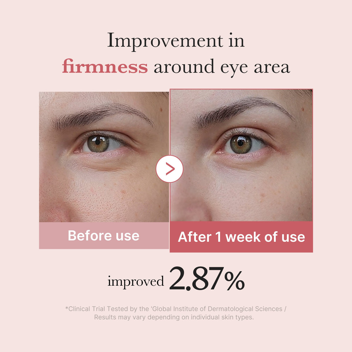 PDRN Pink Peptide Eye Cream F8