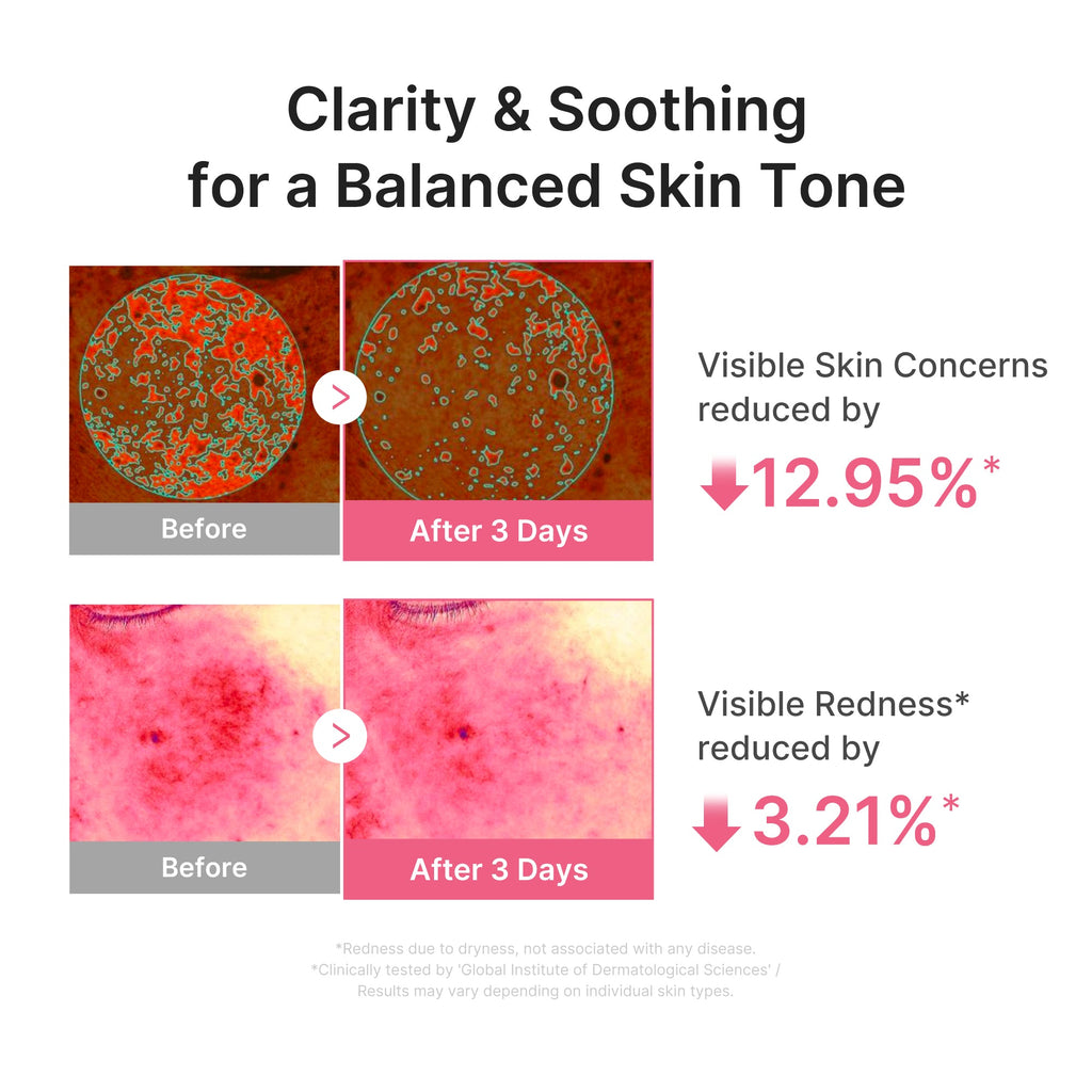 Ultra Light PDRN Pink Peptide Serum X7