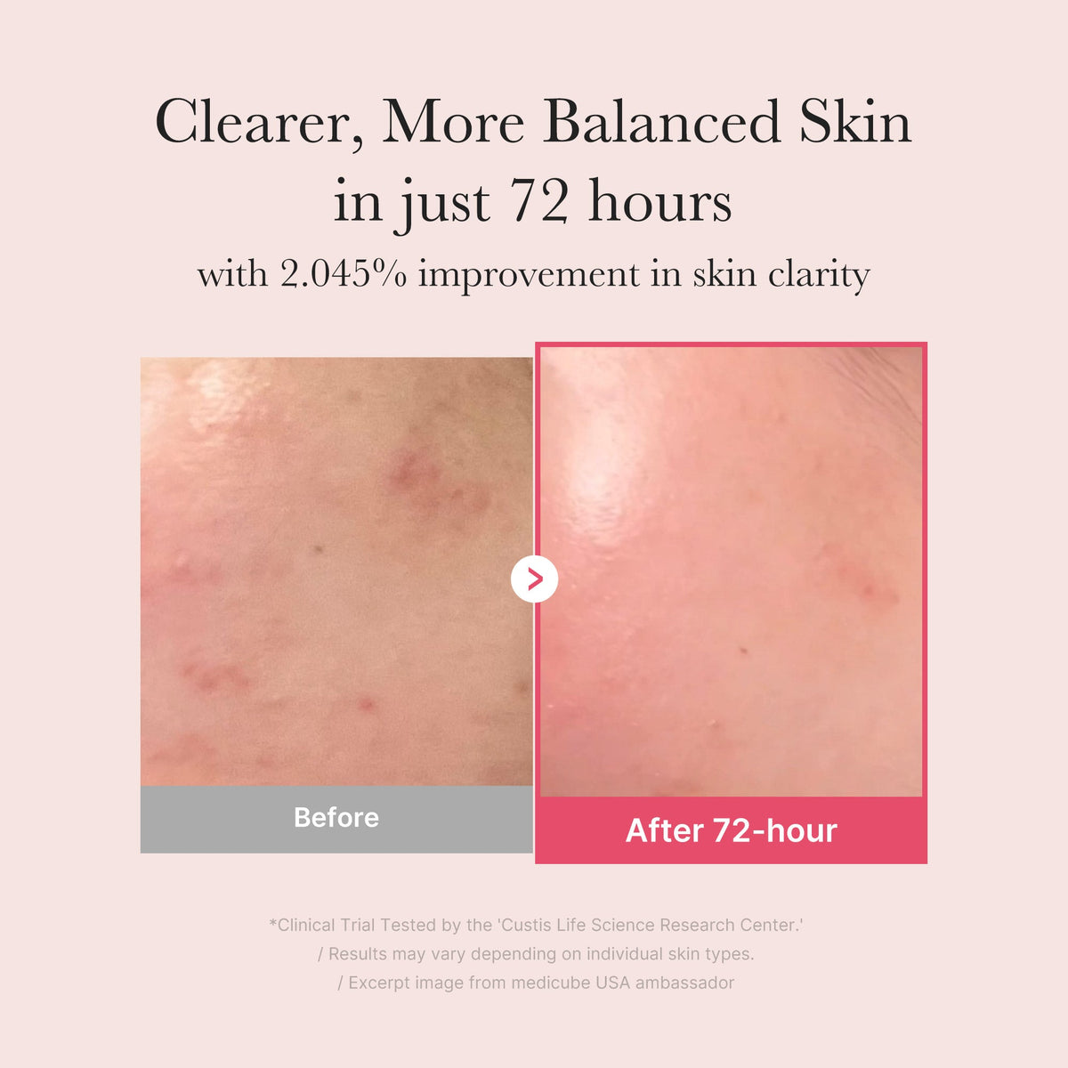 TXA Niacinamide Serum D3
