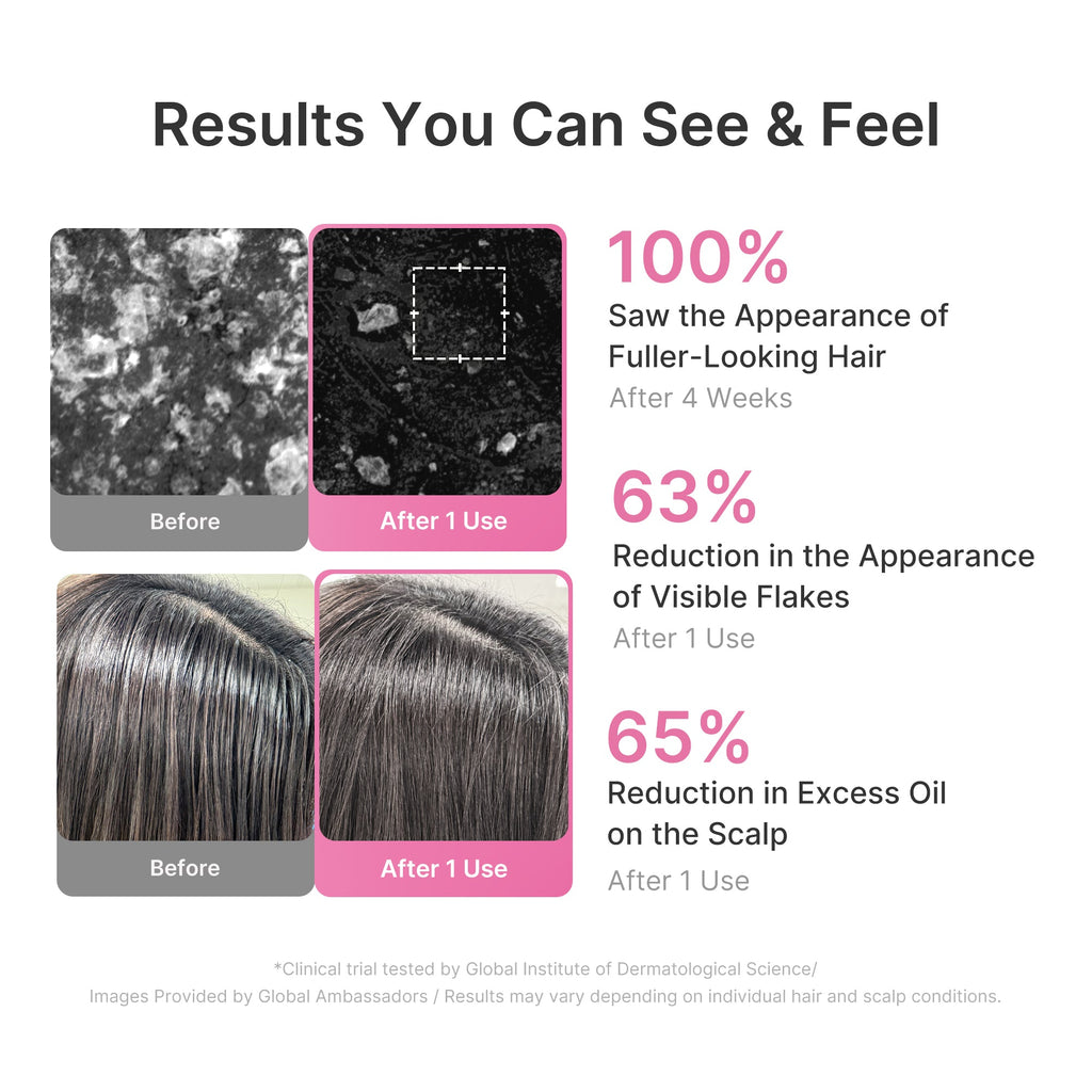 Rosemary PDRN Cooling Thickening Shampoo I7